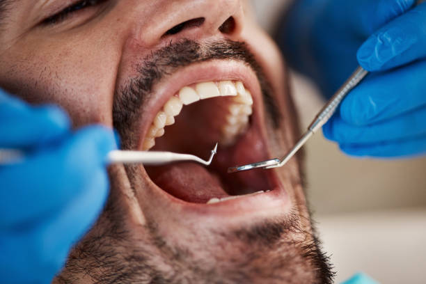 Best Emergency Treatment for Oral Infections in Tyrone, OK