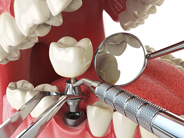 Best Emergency Wisdom Tooth Extraction in Tyrone, OK